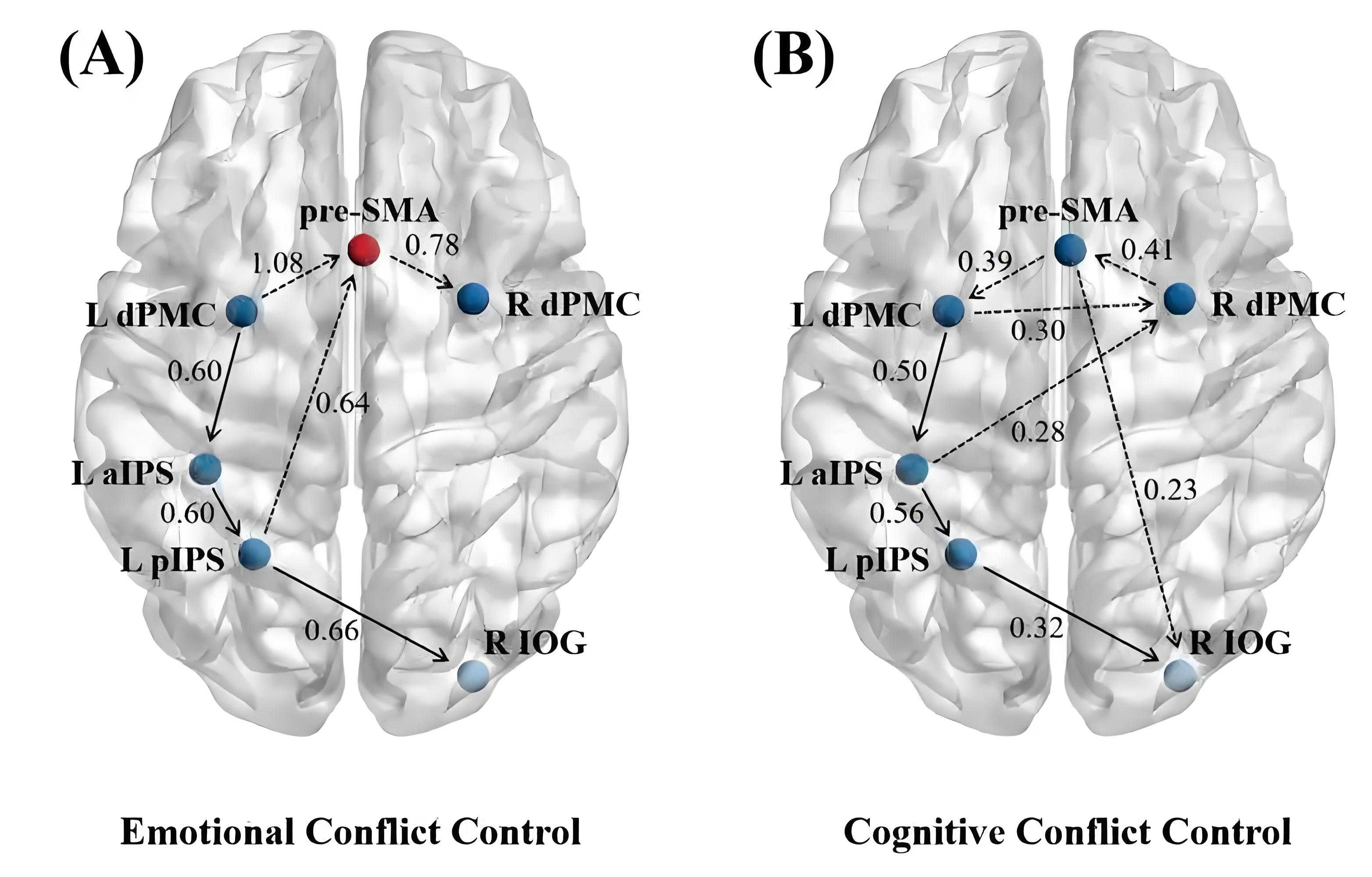 训练前后大脑fMRI对比